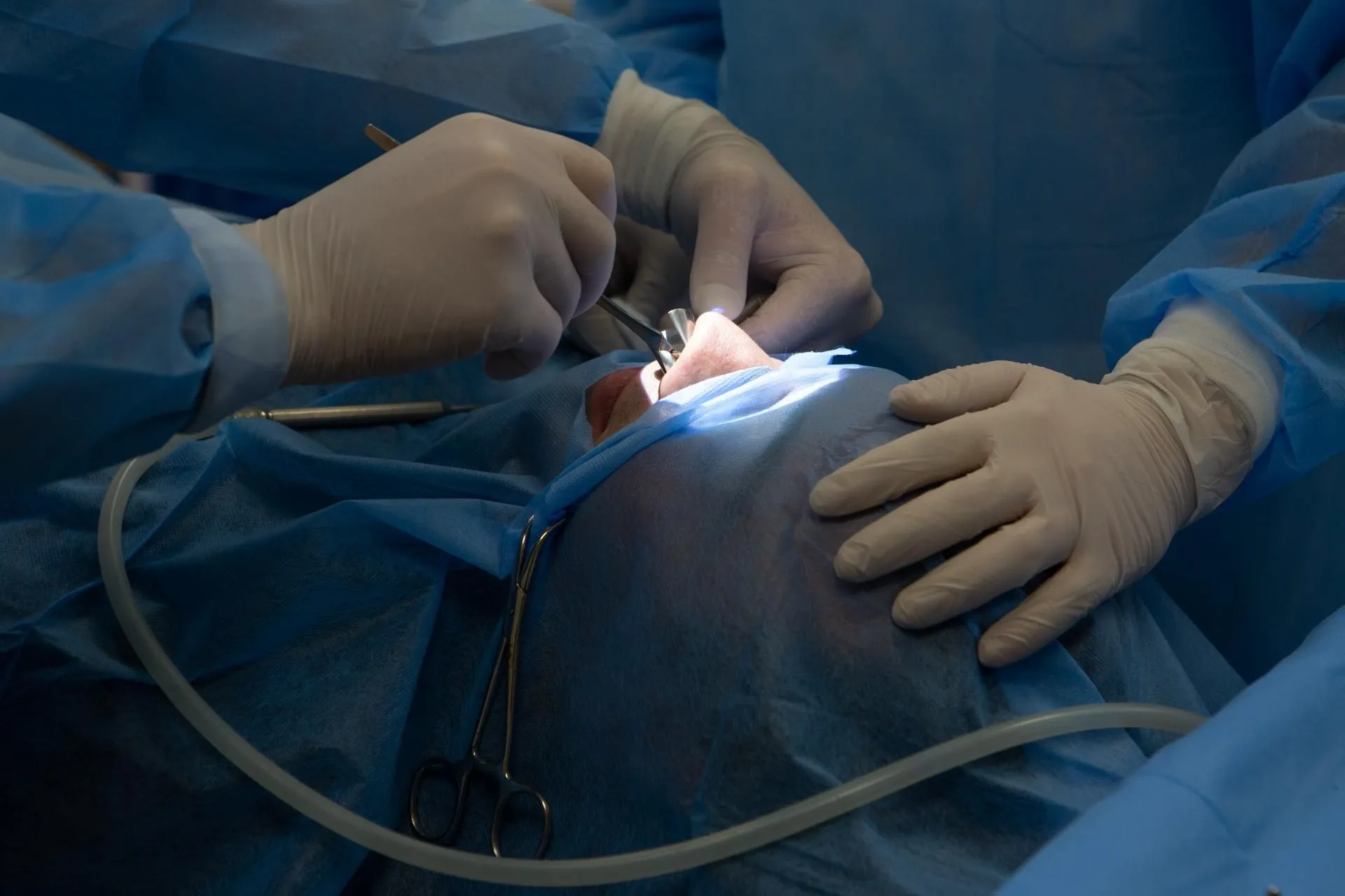 Пластична операція з виправлення носової перегородки