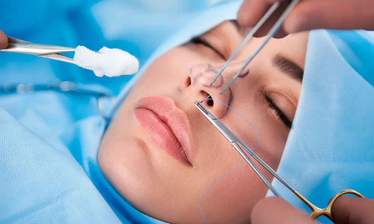 Септопластика