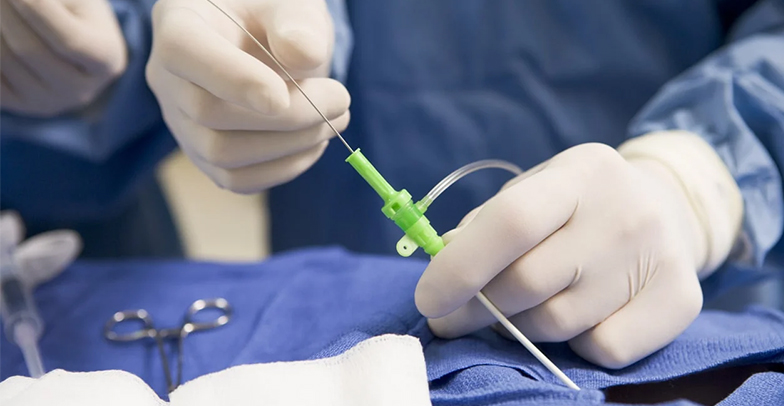 Коронарографія